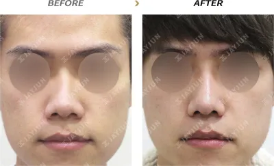Before & After