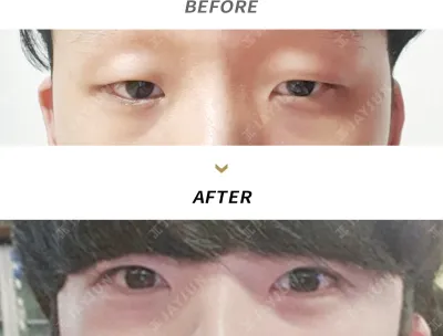 Before & After