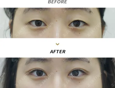 Before & After