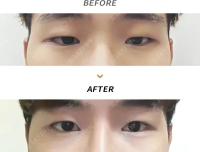 Before & After