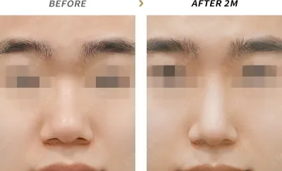 Before & After