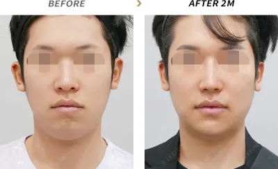 Before & After