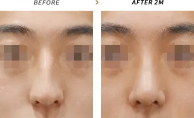 Before & After