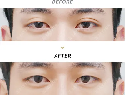 Before & After