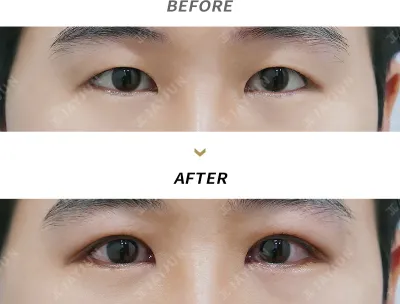Before & After