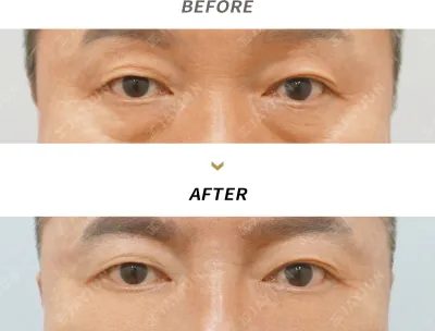 Before & After