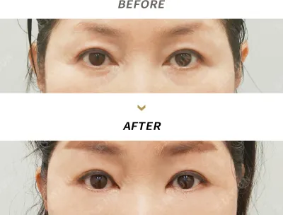 Before & After
