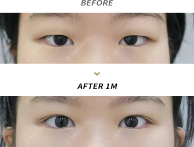 Before & After