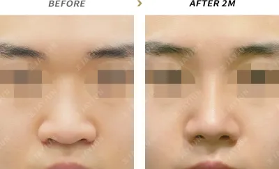 Before & After