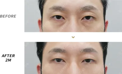 Before & After