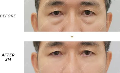Before & After