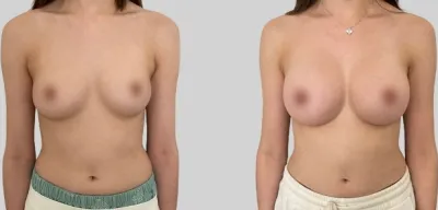 Before & After