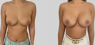 Before & After