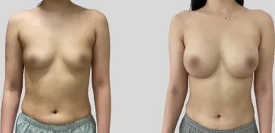 Before & After