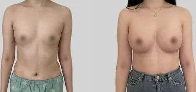 Before & After