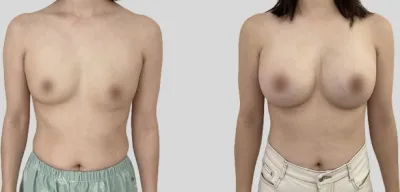 Before & After