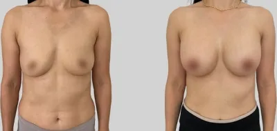 Before & After