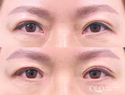 Before & After