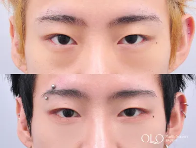 Before & After