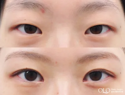 Before & After