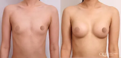 Before & After