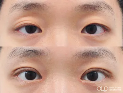 Before & After