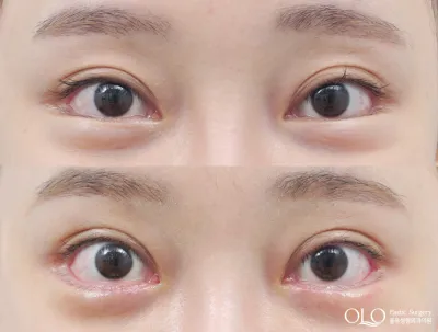Before & After