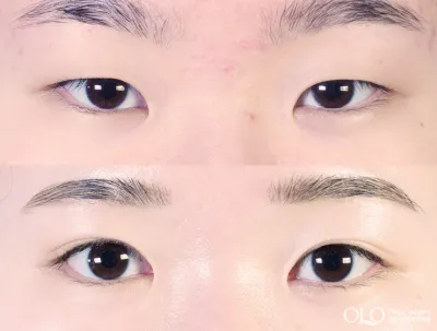 Before & After