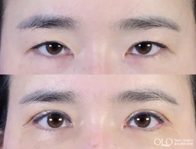 Before & After