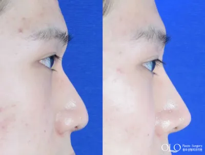 Before & After