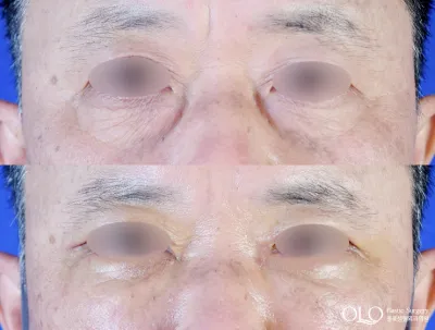 Before & After