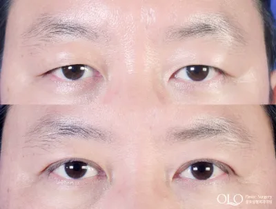 Before & After