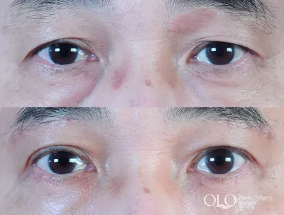 Before & After
