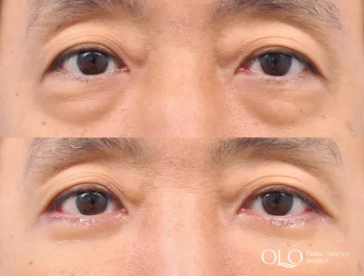 Before & After