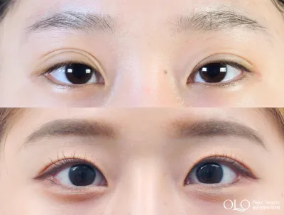 Before & After