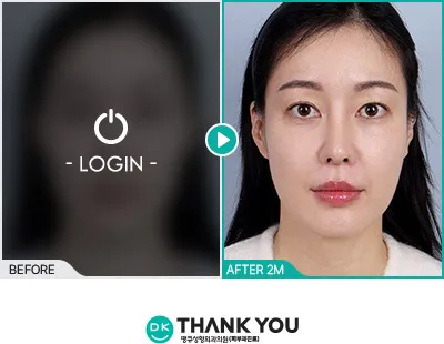 Before & After