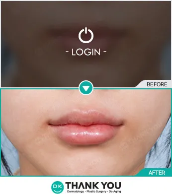 Before & After