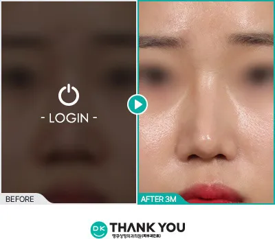 Before & After