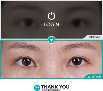 Before & After