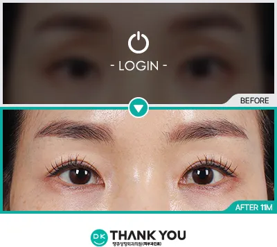 Before & After