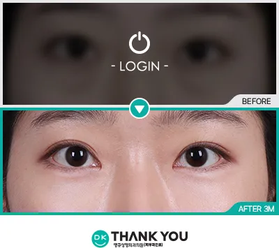 Before & After