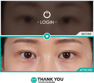 Before & After