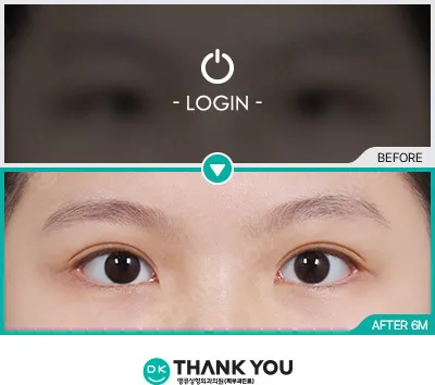 Before & After