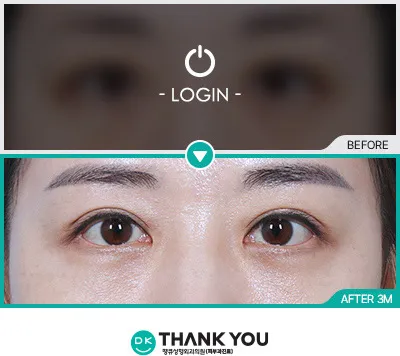 Before & After