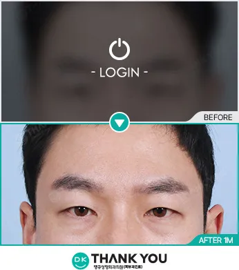 Before & After