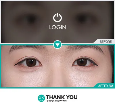 Before & After