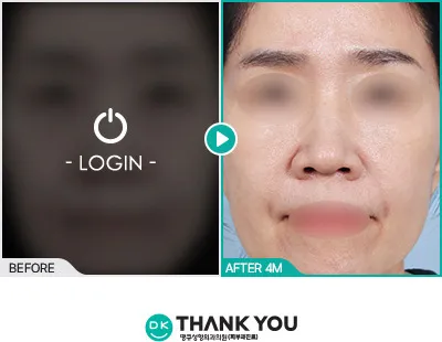 Before & After