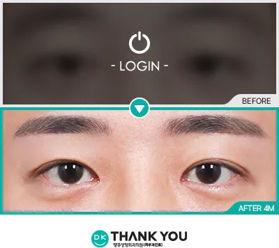 Before & After