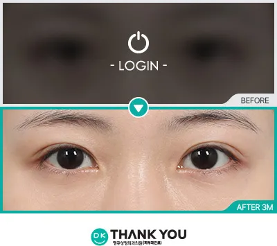 Before & After