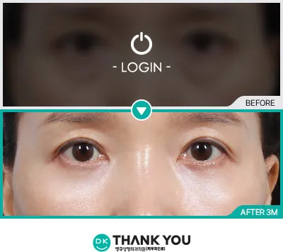 Before & After